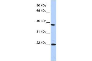Western Blotting (WB) image for anti-Proteasome (Prosome, Macropain) Subunit, beta Type 2 (PSMB2) antibody (ABIN2459969) (PSMB2 antibody)