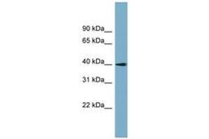 Image no. 1 for anti-Solute Carrier Family 25 (Mitochondrial Carrier: Glutamate), Member 22 (SLC25A22) (AA 71-120) antibody (ABIN6743230) (SLC25A22 antibody  (AA 71-120))