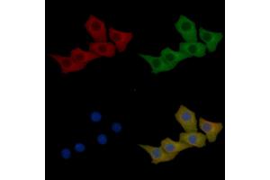 Cytokeratin 16 Mouse Monoclonal Antibody staining Hela cells by IF/ICC.