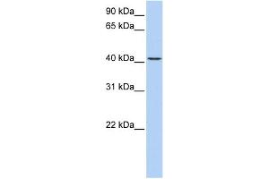 WB Suggested Anti-TMEM144 Antibody Titration:  0. (TMEM144 antibody  (Middle Region))