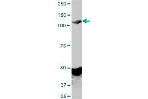 EPHA2 monoclonal antibody (M02), clone 1E3. (EPH Receptor A2 antibody  (AA 204-326))