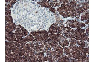 Image no. 2 for anti-Carboxypeptidase A1 (Pancreatic) (CPA1) antibody (ABIN1497589) (CPA1 antibody)