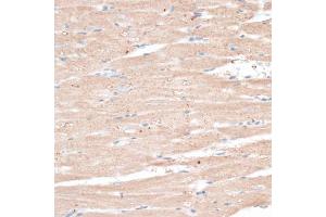 Immunohistochemistry of paraffin-embedded rat heart using ABCB7 antibody (ABIN6291732) at dilution of 1:100 (40x lens). (ABCB7 antibody)