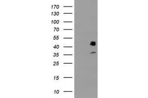 HEK293T cells were transfected with the pCMV6-ENTRY control (Left lane) or pCMV6-ENTRY PDSS2 (Right lane) cDNA for 48 hrs and lysed. (PDSS2 antibody)