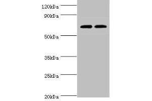 Western blot All lanes: APBB1IP antibody at 4 μg/mL Lane 1: HL60 whole cell lysate Lane 2: Rat spleen tissue Secondary Goat polyclonal to rabbit IgG at 1/10000 dilution Predicted band size: 74, 19 kDa Observed band size: 74 kDa (Amyloid beta (A4) Precursor Protein-Binding, Family B, Member 1 Interacting Protein (APBB1IP) (AA 1-150) antibody)