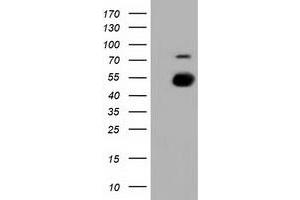 HEK293T cells were transfected with the pCMV6-ENTRY control (Left lane) or pCMV6-ENTRY PKMYT1 (Right lane) cDNA for 48 hrs and lysed. (PKMYT1 antibody)