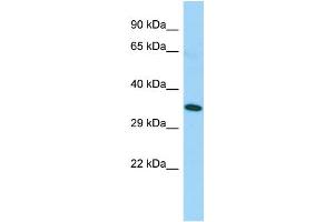 Host: Rabbit Target Name: TAS2R5 Sample Type: Fetal Lung lysates Antibody Dilution: 1. (TAS2R5 antibody  (C-Term))