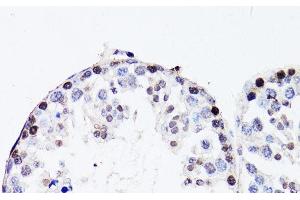 Immunohistochemistry of paraffin-embedded Mouse testis using FGF12 Polyclonal Antibody at dilution of 1:150 (40x lens). (FGF12 antibody)