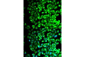 Immunofluorescence analysis of HeLa cells using TBXAS1 antibody. (TBXAS1 antibody)