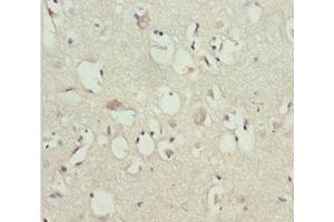 Immunohistochemistry of paraffin-embedded human brain tissue using ABIN7153645 at dilution of 1:100
