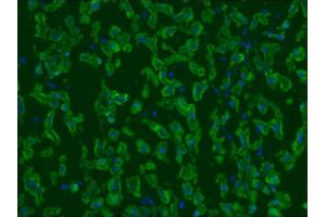Image no. 2 for anti-Keratin 5/8 (KRT5/8) antibody (ABIN335325) (Keratin 5/8 antibody)