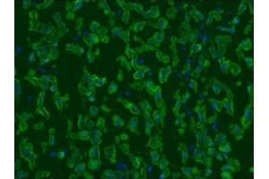 Image no. 2 for anti-Keratin 5/8 (KRT5/8) antibody (ABIN335325) (Keratin 5/8 antibody)