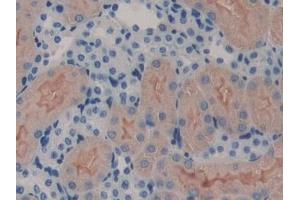 Detection of ErbB3 in Mouse Kidney Tissue using Polyclonal Antibody to V-Erb B2 Erythroblastic Leukemia Viral Oncogene Homolog 3 (ErbB3) (ERBB3 antibody  (AA 707-964))