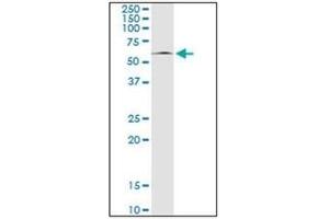 Western Blotting (WB) image for anti-Mitogen-Activated Protein Kinase 8 (MAPK8) antibody (ABIN953306) (JNK antibody)