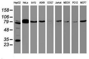Image no. 3 for anti-B-Cell CLL/lymphoma 10 (BCL10) antibody (ABIN1496848) (BCL10 antibody)