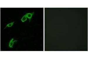 Immunofluorescence analysis of LOVO cells, using GPR75 Antibody. (GPR75 antibody  (AA 381-430))