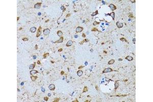 Immunohistochemistry of paraffin-embedded Mouse brain using PDP1 Polyclonal Antibody at dilution of 1:100 (40x lens). (PDP antibody)