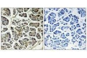 Immunohistochemistry analysis of paraffin-embedded human pancreas tissue using ATP5G2 antibody. (ATP5G2 antibody)