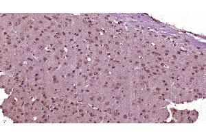 Paraformaldehyde-fixed, paraffin embedded (Mouse brain), Antigen retrieval by boiling in sodium citrate buffer (pH6. (SRRM4 antibody  (AA 451-611))
