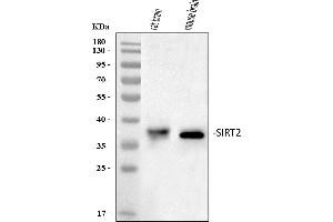 Western blot analysis of SIRT2 using anti-SIRT2 antibody (ABIN3043924). (SIRT2 antibody  (Middle Region))