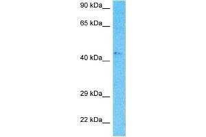 Western Blotting (WB) image for anti-Nuclear Receptor Subfamily 2, Group F, Member 2 (NR2F2) (N-Term) antibody (ABIN2792599)
