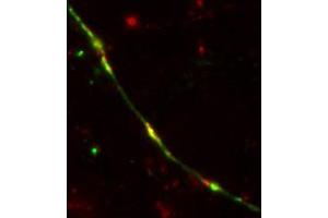 Image no. 3 for anti-TEV (Cut Protease Site) antibody (ABIN1742525) (TEV (Cut Protease Site) antibody)
