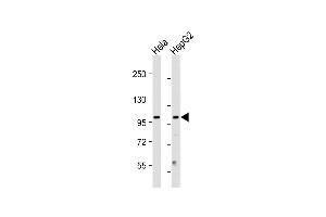 All lanes : Anti-NU Antibody (N-term) at 1:2000 dilution Lane 1: Hela whole cell lysate Lane 2: HepG2 whole cell lysate Lysates/proteins at 20 μg per lane. (NUP210 antibody  (N-Term))