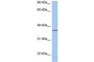 Image no. 1 for anti-Lactate Dehydrogenase A-Like 6B (LDHAL6B) (AA 251-300) antibody (ABIN6743763) (LDHAL6B antibody  (AA 251-300))