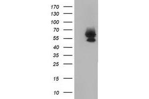 HEK293T cells were transfected with the pCMV6-ENTRY control (Left lane) or pCMV6-ENTRY BEST3 (Right lane) cDNA for 48 hrs and lysed. (Bestrophin 3 antibody)