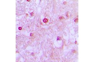 Immunohistochemical analysis of CDK10 staining in human brain formalin fixed paraffin embedded tissue section. (CDK10 antibody  (Center))