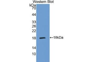 Western Blotting (WB) image for anti-Interleukin 5 Receptor, alpha (IL5RA) (AA 42-182) antibody (ABIN1174731) (IL5RA antibody  (AA 42-182))