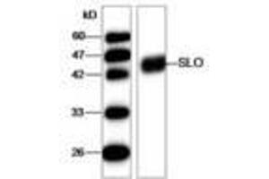 Image no. 1 for anti-Streptolysin O (SLO) (AA 78-206) antibody (ABIN791625) (Streptolysin O antibody  (AA 78-206))