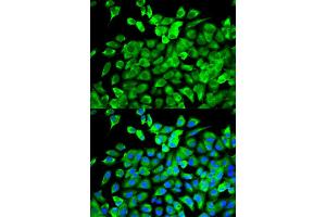 Immunofluorescence (IF) image for anti-Eukaryotic Translation Initiation Factor 4A2 (EIF4A2) antibody (ABIN1876482)