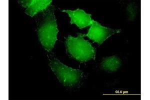Immunofluorescence of purified MaxPab antibody to EPB41L2 on HeLa cell. (EPB41L2 antibody  (AA 1-633))