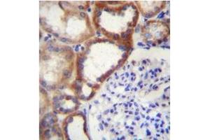 Formalin fixed and paraffin embedded human kidney tissue stained with STARD4 Antibody (N-term) Cat. (STARD4 antibody  (N-Term))