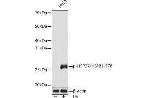 Western blot analysis of extracts of HeLa cells, using Phospho-HSP27/HSPB1-S78 Rabbit mAb (ABIN7267570) at 1:1000 dilution. (HSP27 antibody  (pSer78))