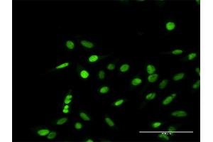 Immunofluorescence of purified MaxPab antibody to RPA1 on HeLa cell. (RPA1 antibody  (AA 1-616))