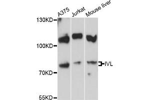 Western blot analysis of extracts of various cell lines, using IVL antibody (ABIN5995560) at 1:3000 dilution. (Involucrin antibody)