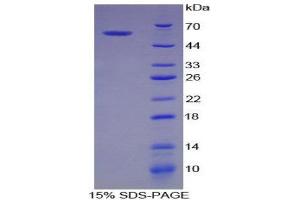 SDS-PAGE (SDS) image for Baculoviral IAP Repeat Containing 2 (BIRC2) (AA 344-593) protein (His tag,GST tag) (ABIN1981158)