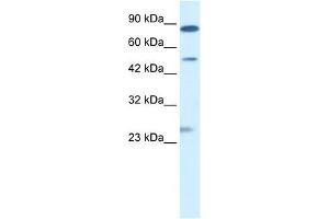 CLIC6 antibody used at 0. (CLIC6 antibody  (Middle Region))