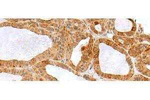 RPS16 antibody