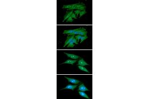 ICC/IF analysis of PDCL3 in HeLa cells line, stained with DAPI (Blue) for nucleus staining and monoclonal anti-human PDCL3 antibody (1:100) with goat anti-mouse IgG-Alexa fluor 488 conjugate (Green). (PDCL3 antibody)