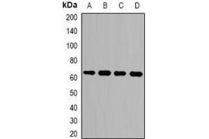 Western blot analysis of LGALS3BP expression in mouse lung (A), mouse brain (B), mouse kidney (C), mouse heart (D) whole cell lysates. (LGALS3BP antibody)