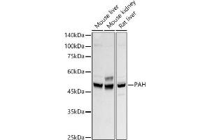 Western blot analysis of extracts of various cell lines, using PAH antibody (ABIN7269264) at 1:500 dilution. (Phenylalanine Hydroxylase antibody)