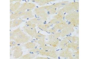 Immunohistochemistry of paraffin-embedded Mouse heart using CXCR3 Polyclonal Antibody at dilution of 1:100 (40x lens). (CXCR3 antibody)