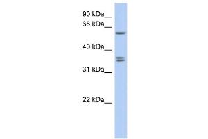 SLC19A3 antibody used at 1 ug/ml to detect target protein. (SLC19A3 antibody  (Middle Region))