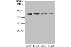 Western blot All lanes: NUP43 antibody at 4 μg/mL Lane 1: A431 whole cell lysate Lane 2: HL60 whole cell lysate Lane 3: THP-1 whole cell lysate Lane 4: A549 whole cell lysate Secondary Goat polyclonal to rabbit IgG at 1/10000 dilution Predicted band size: 43, 32 kDa Observed band size: 43 kDa (NUP43 antibody  (AA 1-200))