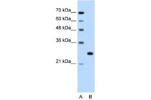 Western Blot showing FOXR2 antibody used at a concentration of 1-2 ug/ml to detect its target protein. (FOXR2 antibody  (N-Term))