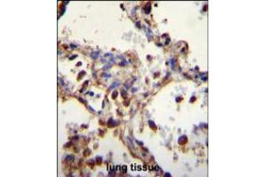 WDR52 Antibody immunohistochemistry analysis in formalin fixed and paraffin embedded human lung tissue followed by peroxidase conjugation of the secondary antibody and DAB staining. (WDR52 antibody  (C-Term))