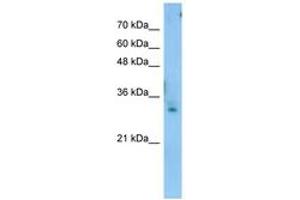 Image no. 1 for anti-Testis Expressed 264 (TEX264) (C-Term) antibody (ABIN6743447) (TEX264 antibody  (C-Term))